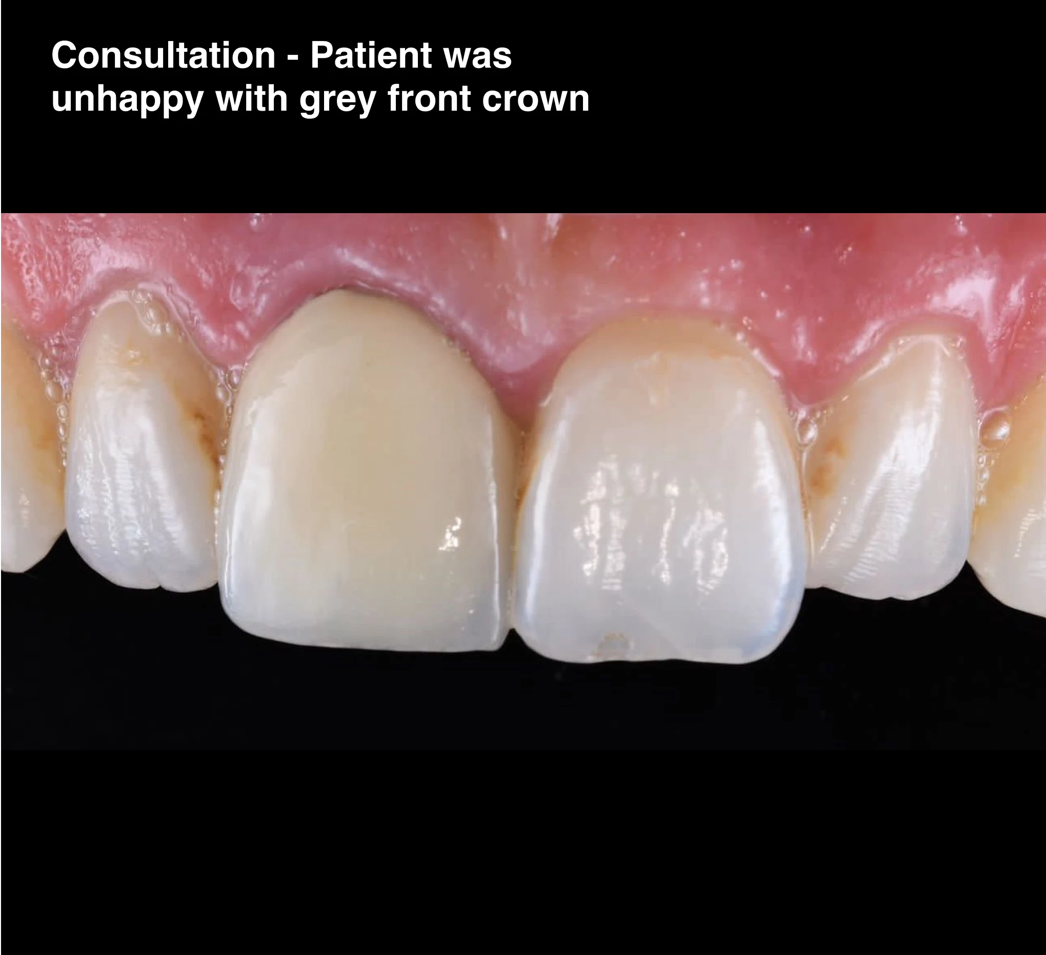 consult-1