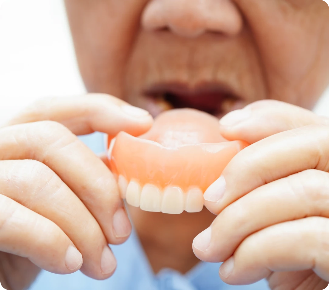 dentures-3