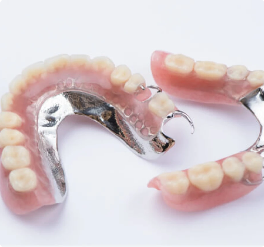implant