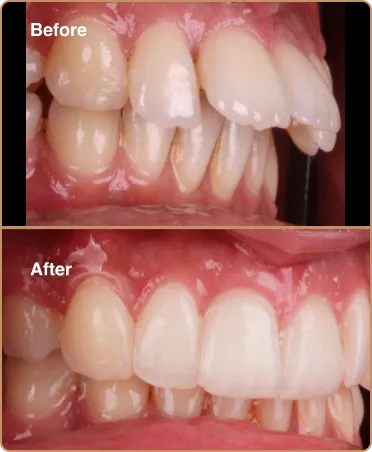 1-option-4howlon