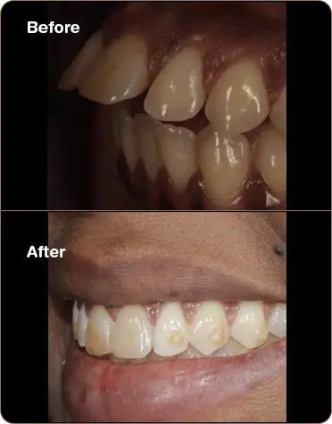 Before-and-After_1-1