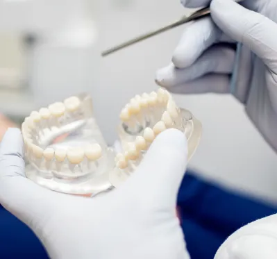 Dental_Bridge