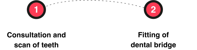 Steps