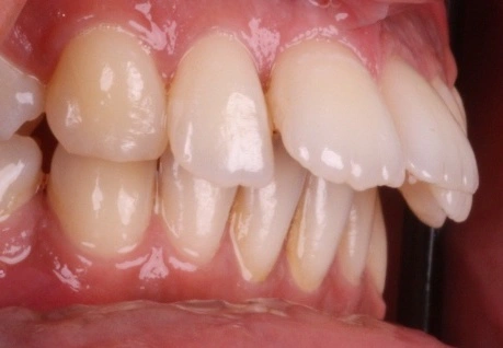 TN640x400-VOI27710867_i_buccal_right