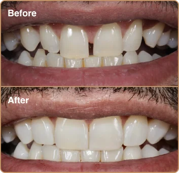dental-treatment-before-after-img-4
