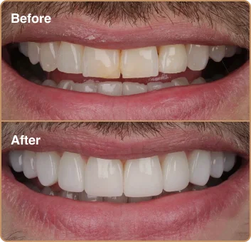 dental-treatment-before-after-img-7