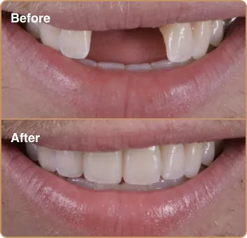 dental_before_after_1