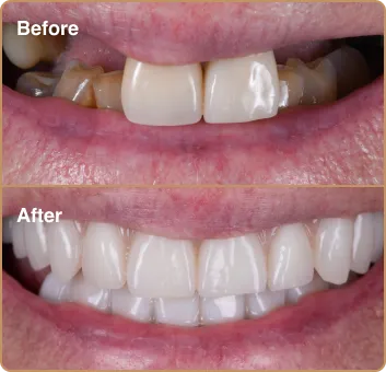 dental_before_after_2