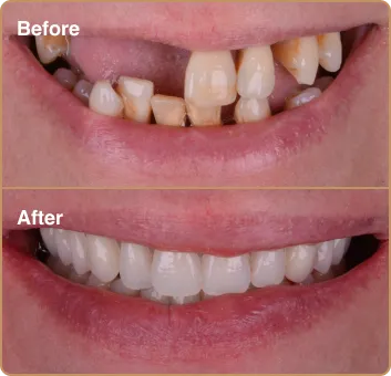 dental_before_after_3