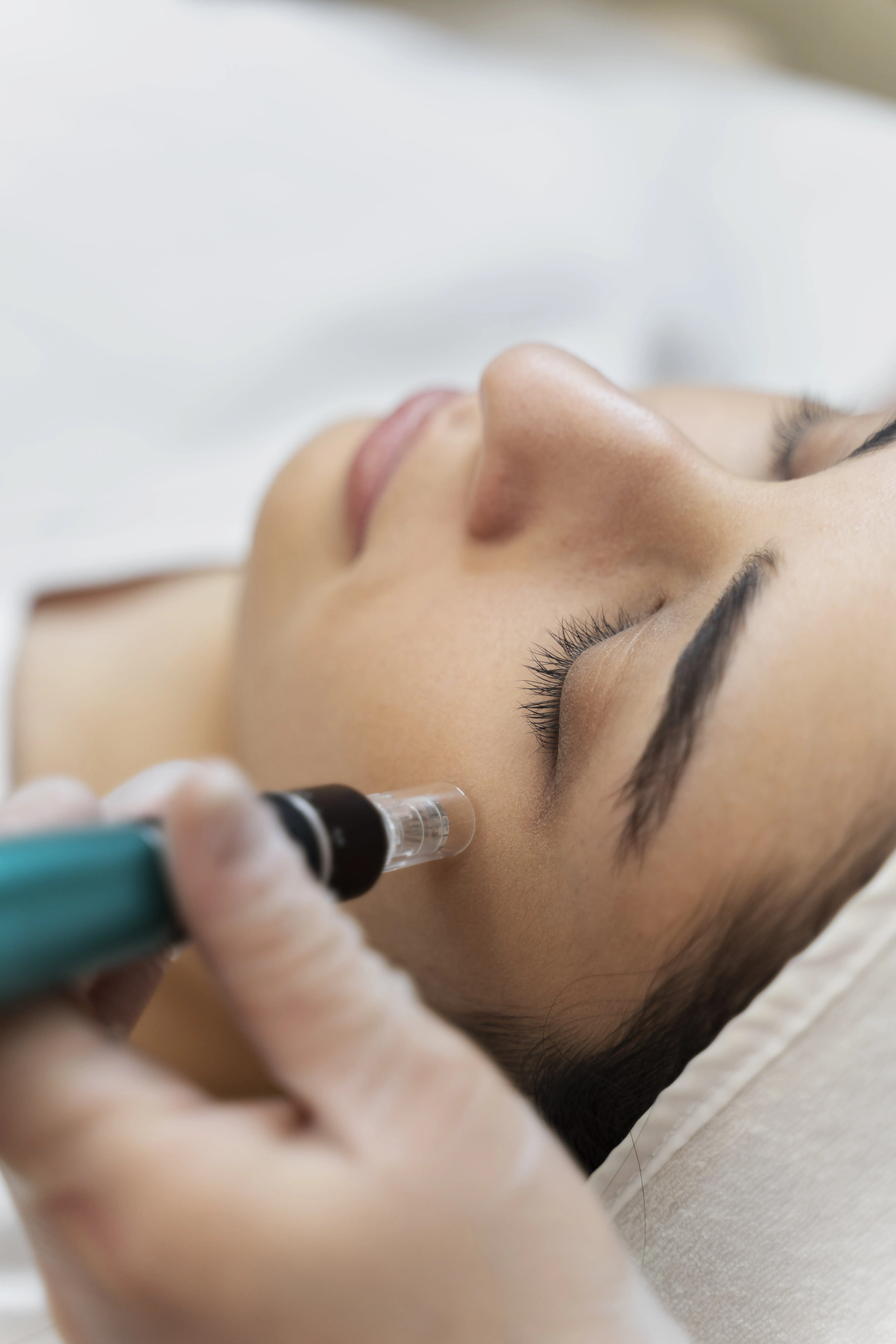 person-getting-micro-needling-beauty-treatment-min