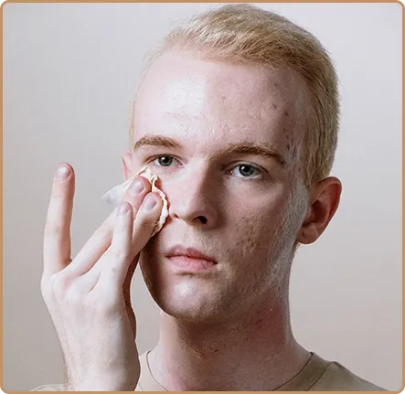 skin_hydration