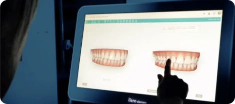 smile-simulation