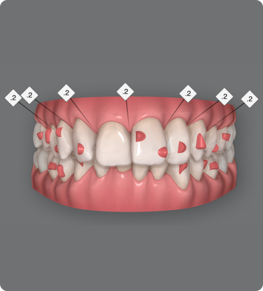 woman-getting-a-dental-cleaning-4490311