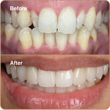 Before and After 1C