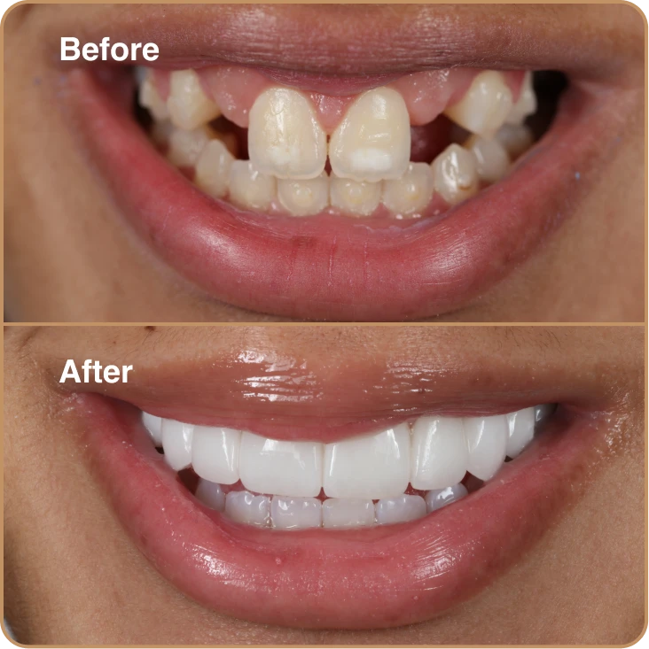 before_and_after_1a