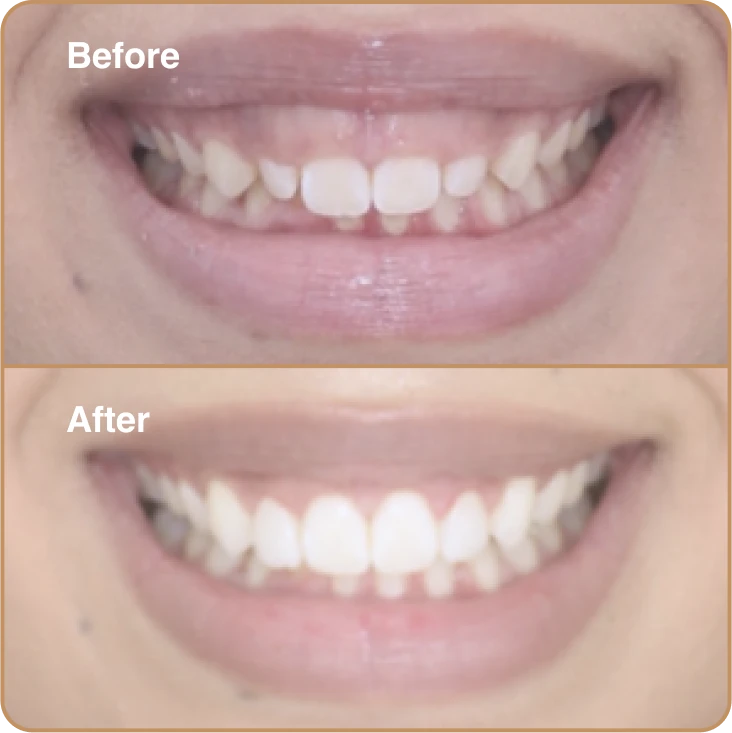 before_and_after_1b