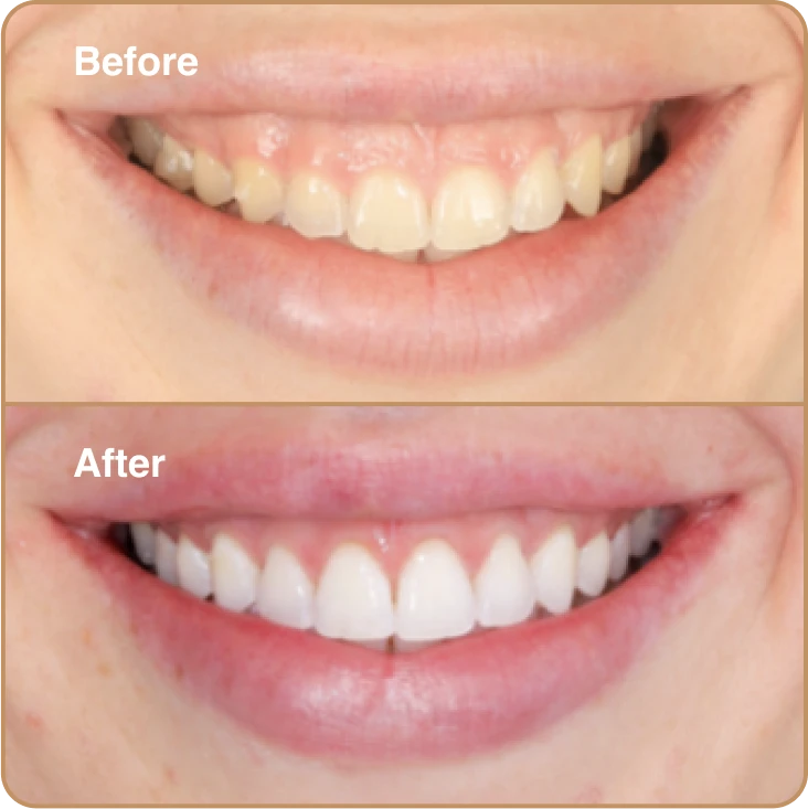 before_and_after_1c