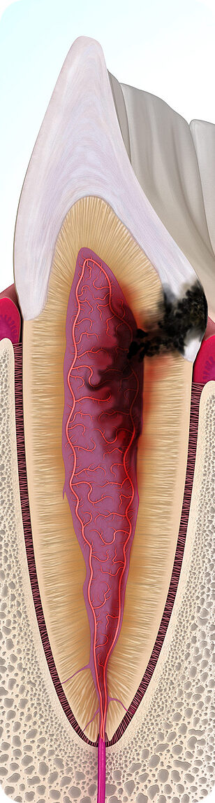 Dental Illustrations by Alex Mit