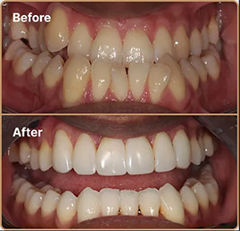 tooths-upd