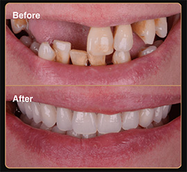 tooths-upd2